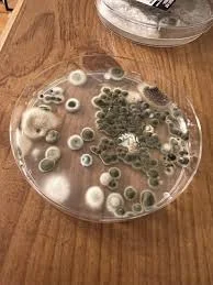 Close-up of petri dish mold sample with various spore types