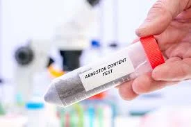 Laboratory asbestos content test related to asbestos exposure symptoms skin