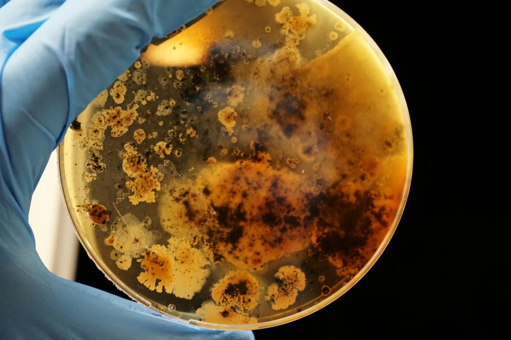 Biotoxin disease linked to mold exposure shown through laboratory testing and microbial growth.